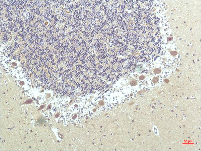 Anti-PPAR delta Mouse mAb [66L62M02]