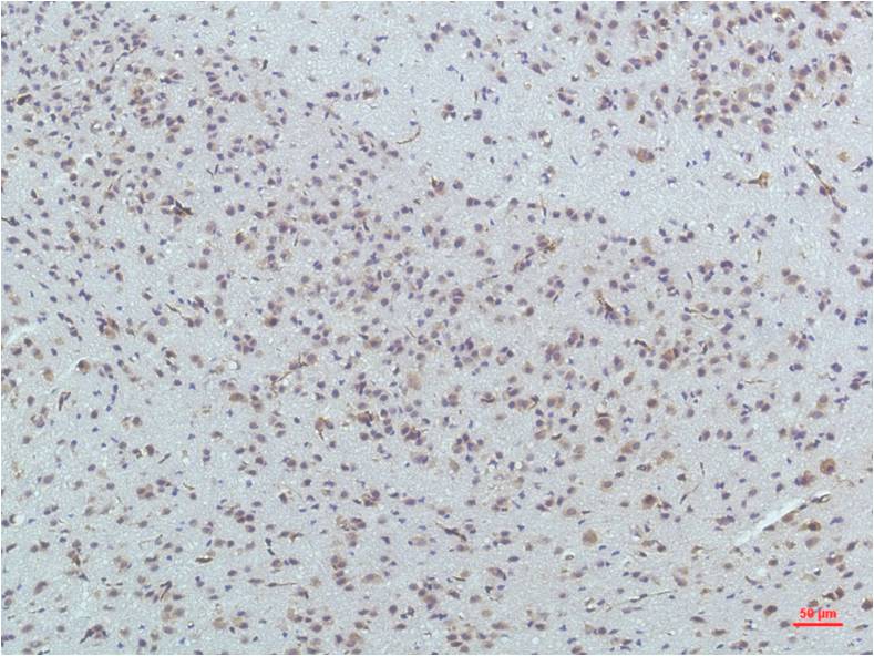 Anti-PPAR delta Mouse mAb [66L62M02]