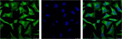 Anti-NF-KB p65 Mouse mAb [40K32K19]