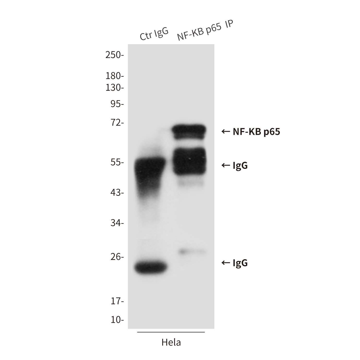 Anti-NF-KB p65 Mouse mAb [40K32K19]