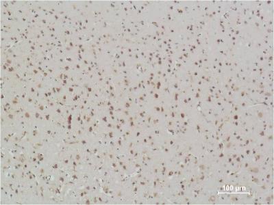 Anti-NF-KB p65 Mouse mAb [40K32K19]