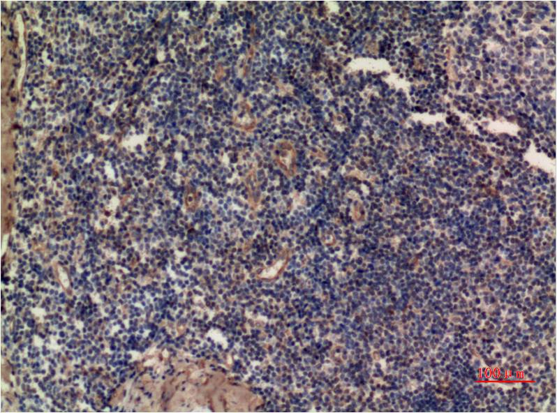 Anti-ERK1 Mouse mAb [18M28L14]