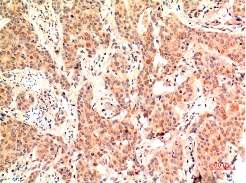 Anti-ERK1 Mouse mAb [18M28L14]