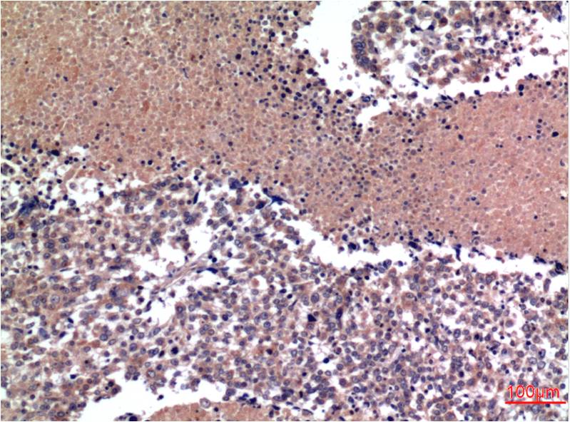 Anti-Cyclin B1 Mouse mAb [50L55M11]