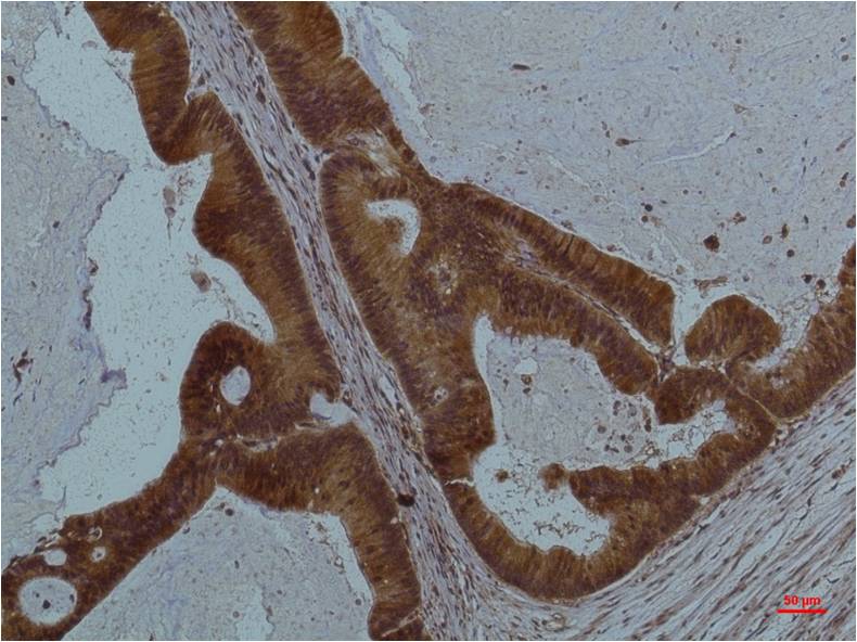 Anti-STAT3 Mouse mAb [47L67K11]
