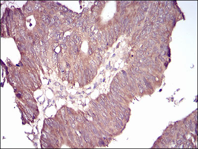 Anti-GSK3 beta Mouse mAb [72K74K70]