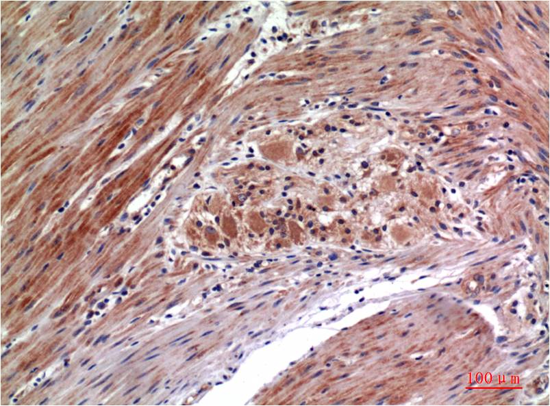 Anti-Phospho-ERK1/2 (Tyr222/Tyr205) Mouse mAb [53M93L10]