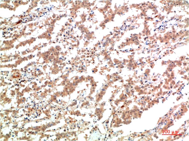 Anti-JAK2 Mouse mAb [34M56K39]