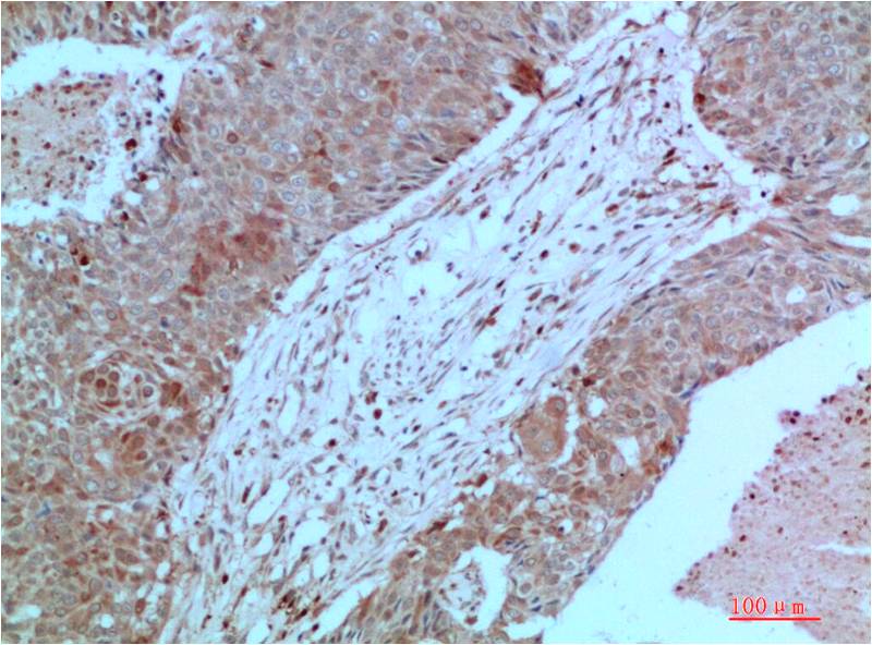 Anti-JAK2 Mouse mAb [34M56K39]