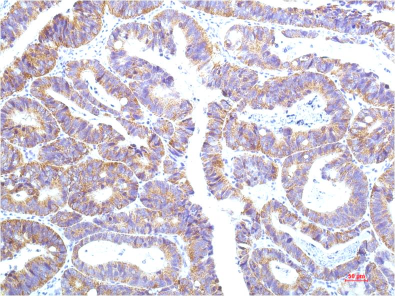 Anti-STAT1 Mouse mAb [87L01K87]