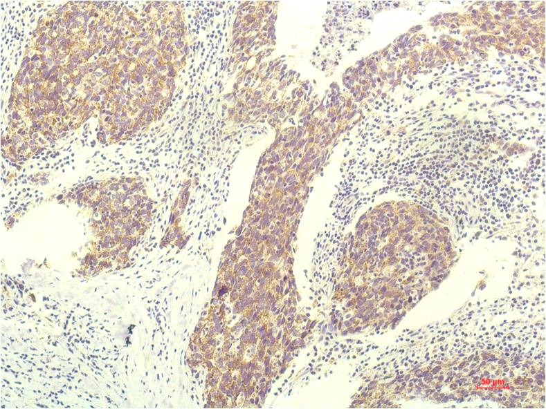 Anti-STAT1 Mouse mAb [87L01K87]