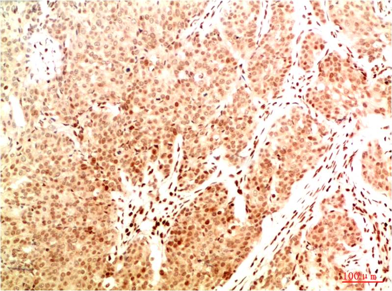 Anti-Acetyl-NF-KB p65 (Lys314/Lys315) Mouse mAb [78K80K24]
