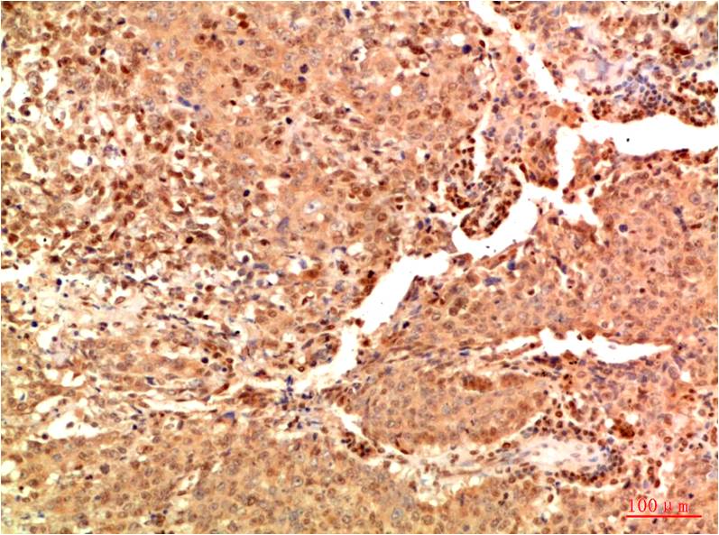 Anti-Acetyl-NF-KB p65 (Lys314/Lys315) Mouse mAb [78K80K24]