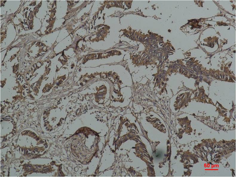 Anti-Hsp27 Mouse mAb [17M68L67]