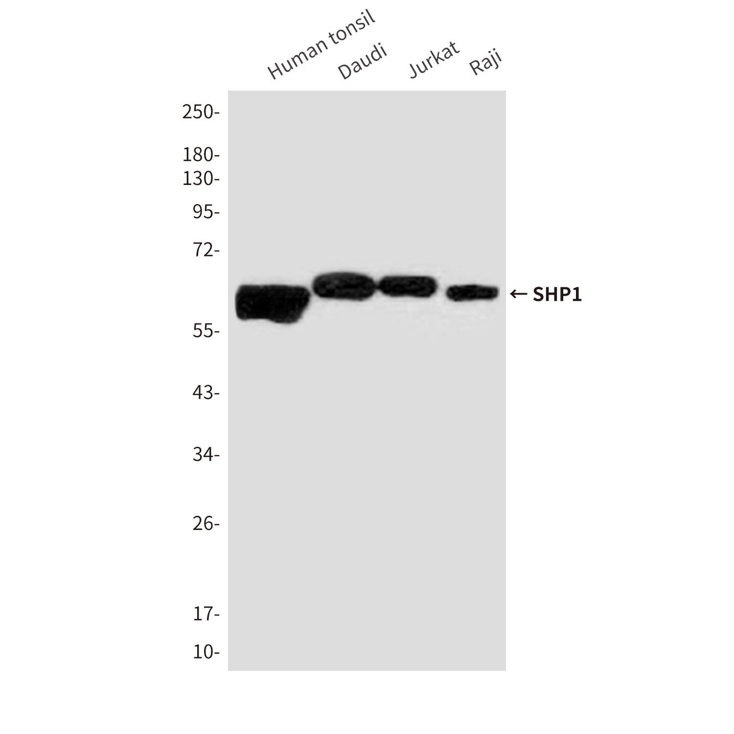 Anti-SHP1 Mouse mAb [53M79M38]