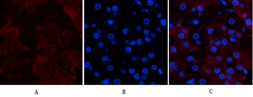 Anti-CD23 Mouse mAb [88L05L95]