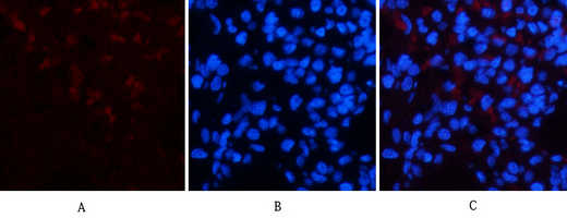 Anti-CD23 Mouse mAb [88L05L95]