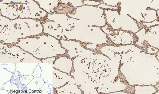 Anti-CD23 Mouse mAb [88L05L95]