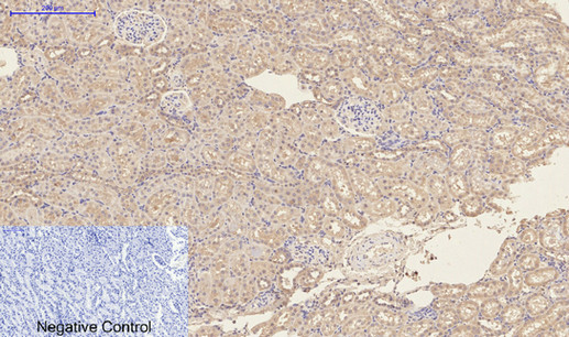 Anti-CD23 Mouse mAb [88L05L95]