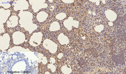Anti-CD23 Mouse mAb [88L05L95]