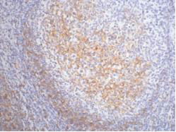 Anti-CD23 Mouse mAb [88L05L95]