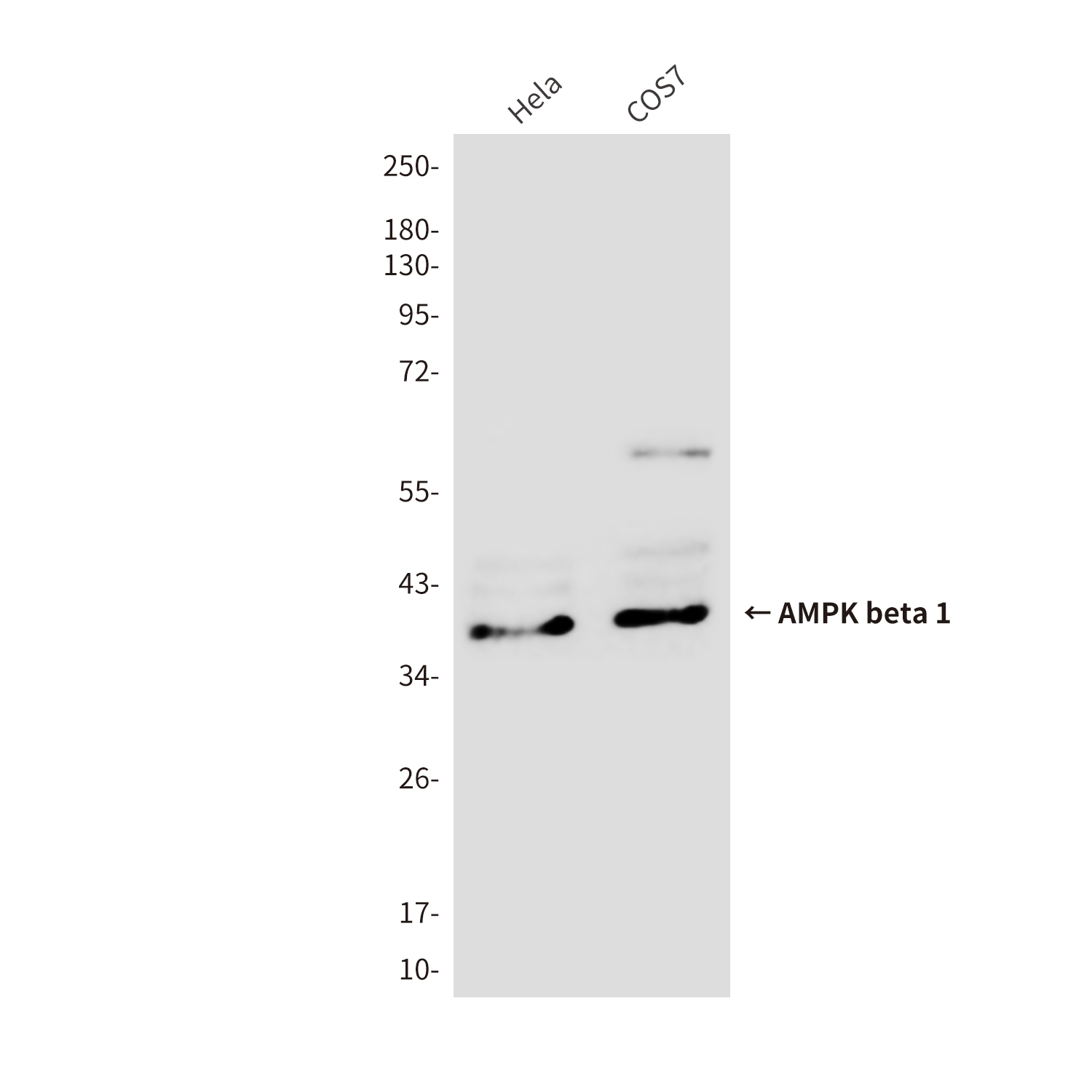 Anti-AMPK beta 1 Mouse mAb [87K42K39]