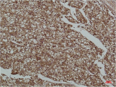 Anti-Smad3 Mouse mAb [38L53M73]