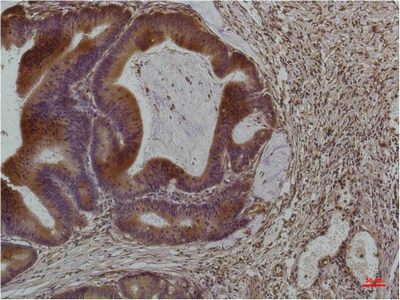 Anti-Smad3 Mouse mAb [38L53M73]