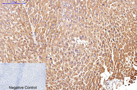 Anti-IL-2 Receptor alpha Mouse mAb [80K42M39]