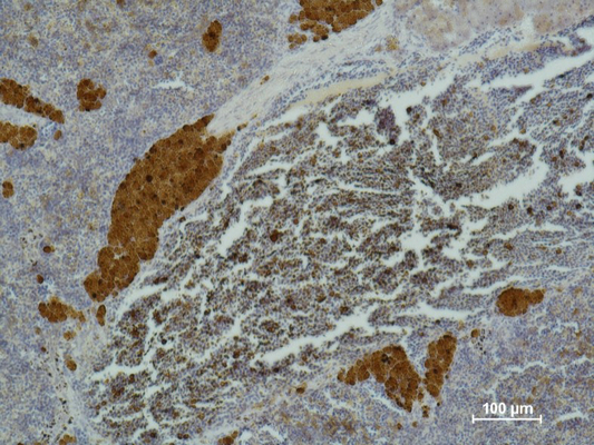 Anti-IL-2 Receptor alpha Mouse mAb [80K42M39]