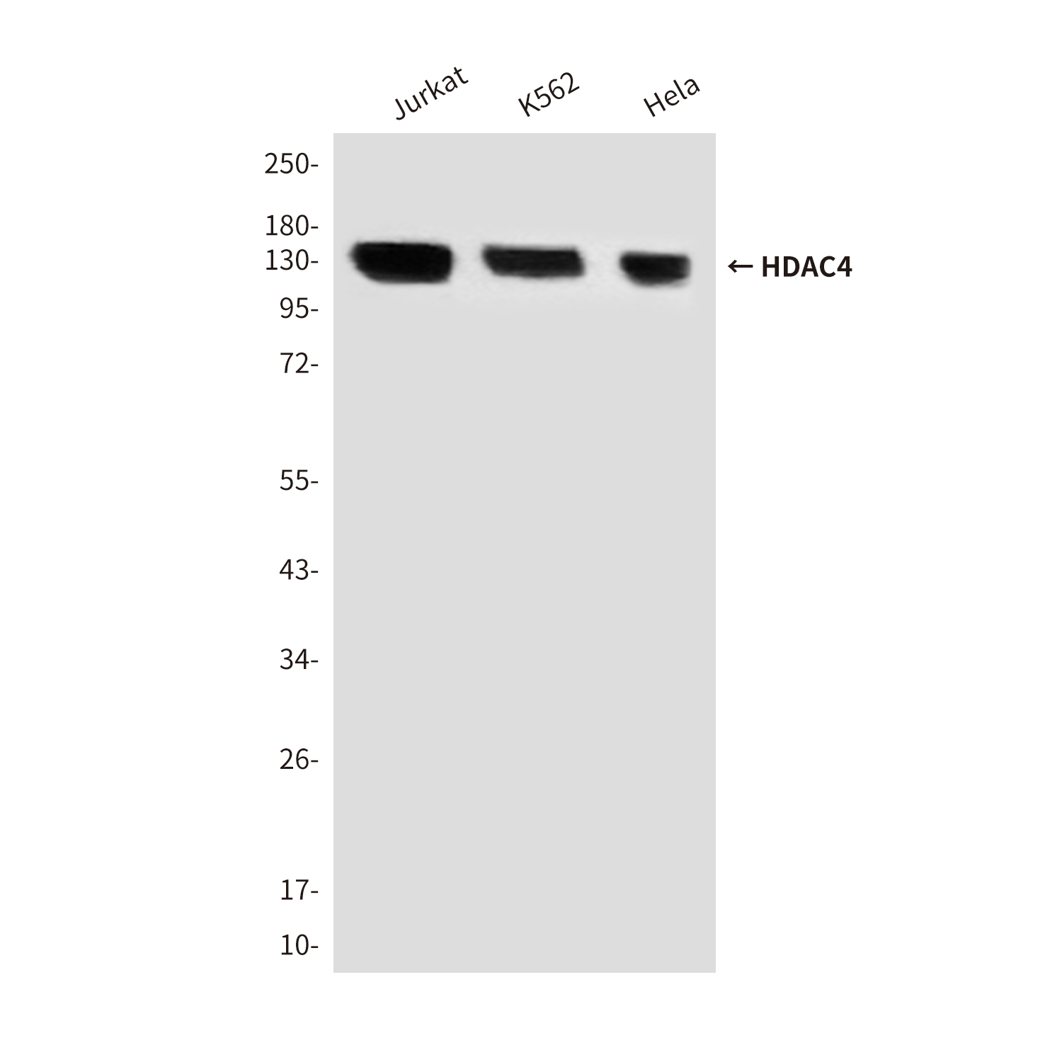 Anti-HDAC4 Mouse mAb [18L89L31]