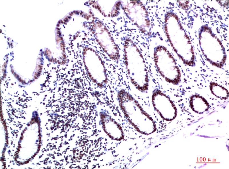 Anti-HP1 gamma Mouse mAb [72K19K71]