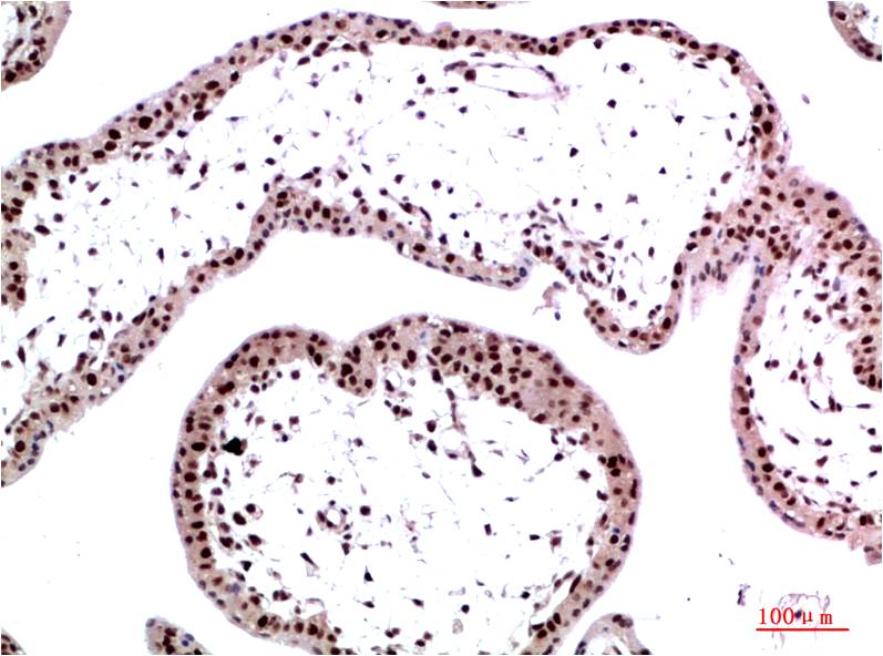 Anti-HP1 gamma Mouse mAb [72K19K71]