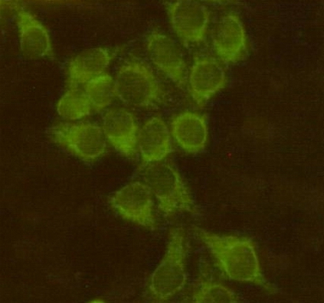 Anti-Bid Mouse mAb [22M87L71]