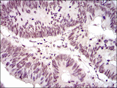 Anti-NCK1 Mouse mAb [35L71K83]