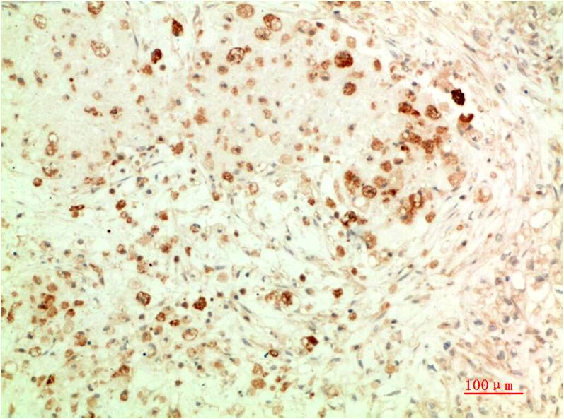 Anti-APG5L Mouse mAb [72M40M65]