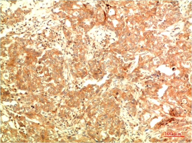 Anti-APG5L Mouse mAb [72M40M65]