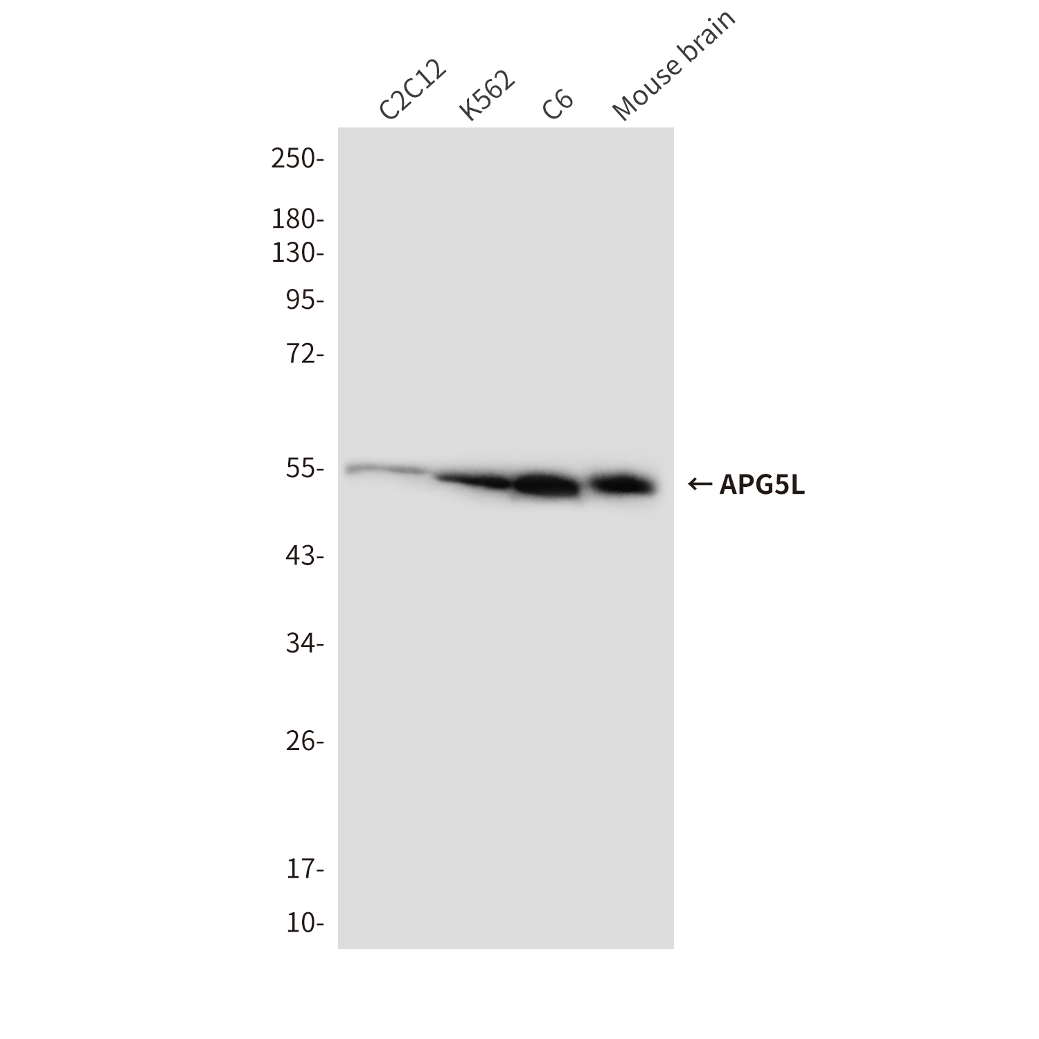 Anti-APG5L Mouse mAb [72M40M65]