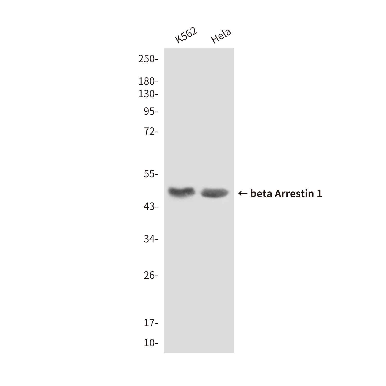 Anti-beta Arrestin 1 Mouse mAb [15M67L12]