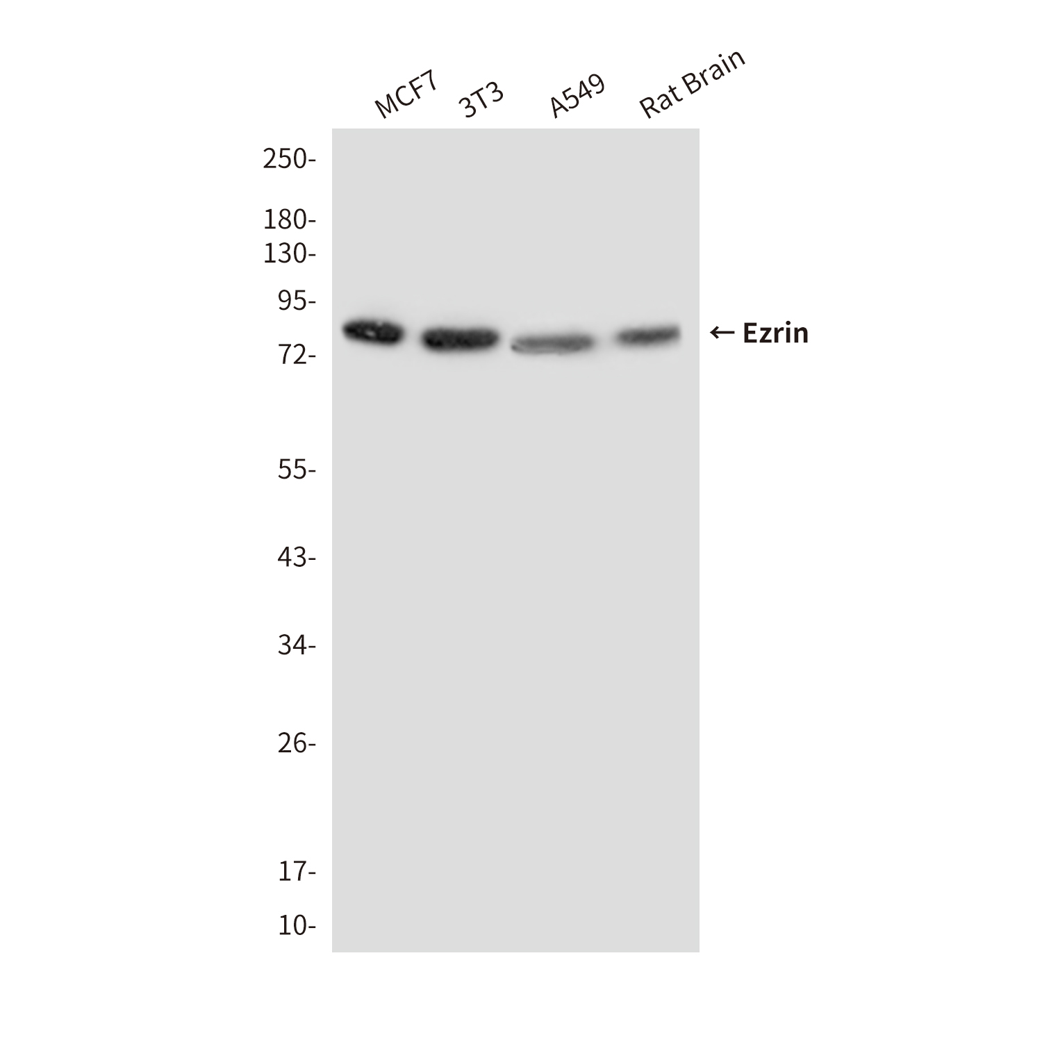 Anti-Ezrin Mouse mAb [42L79K71]