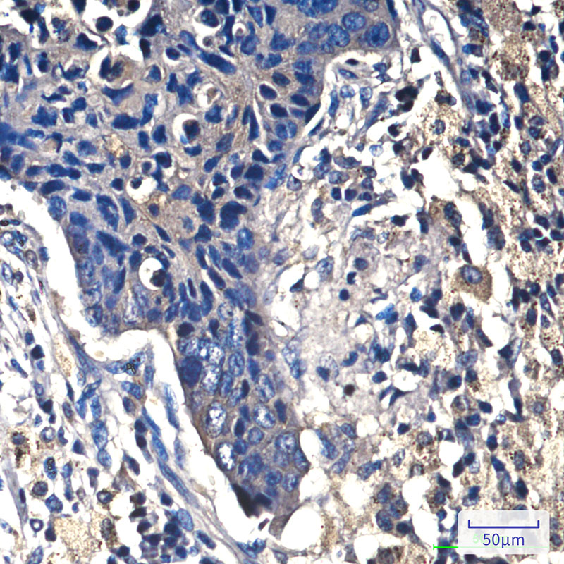 Anti-beta Catenin Mouse mAb [98L81L18]