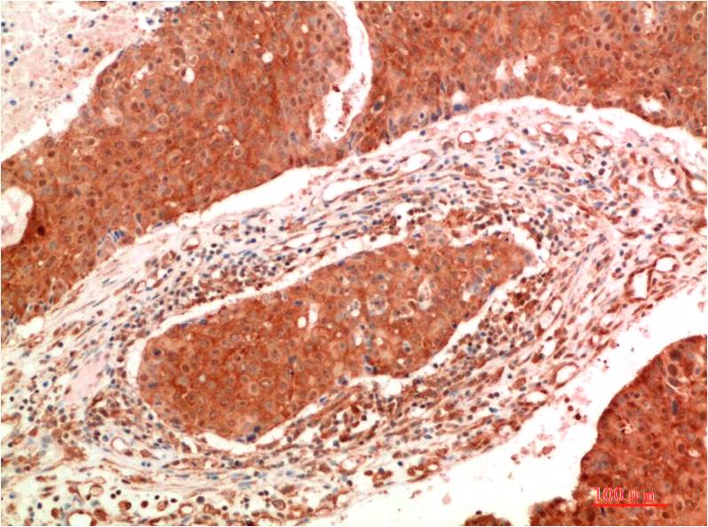 Anti-JAK2 Mouse mAb [33L37K33]