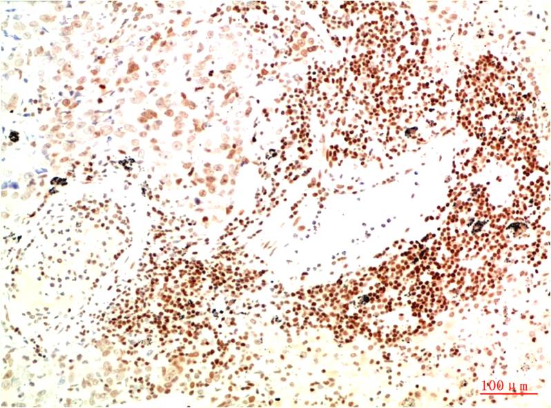 Anti-JAK2 Mouse mAb [33L37K33]