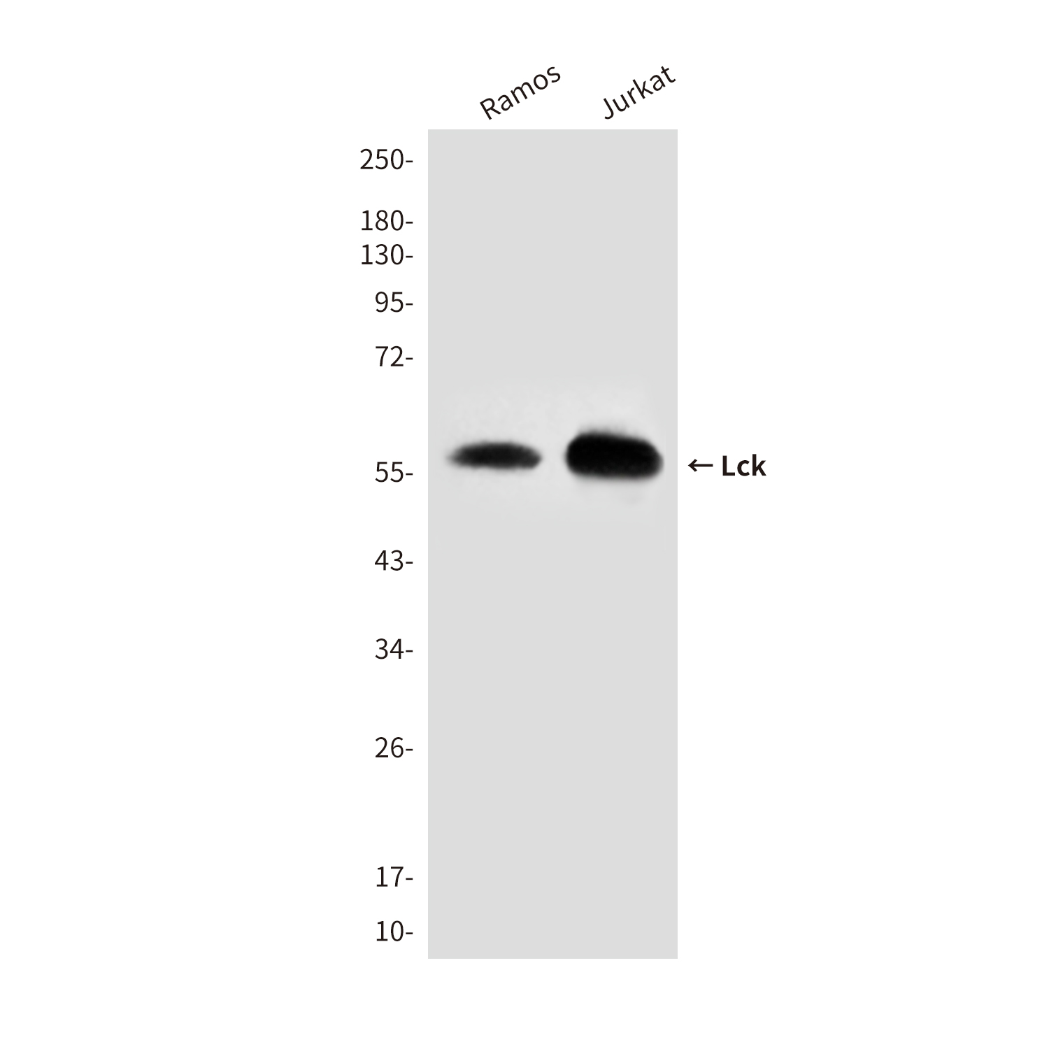 Anti-Lck Mouse mAb [72L49K38]