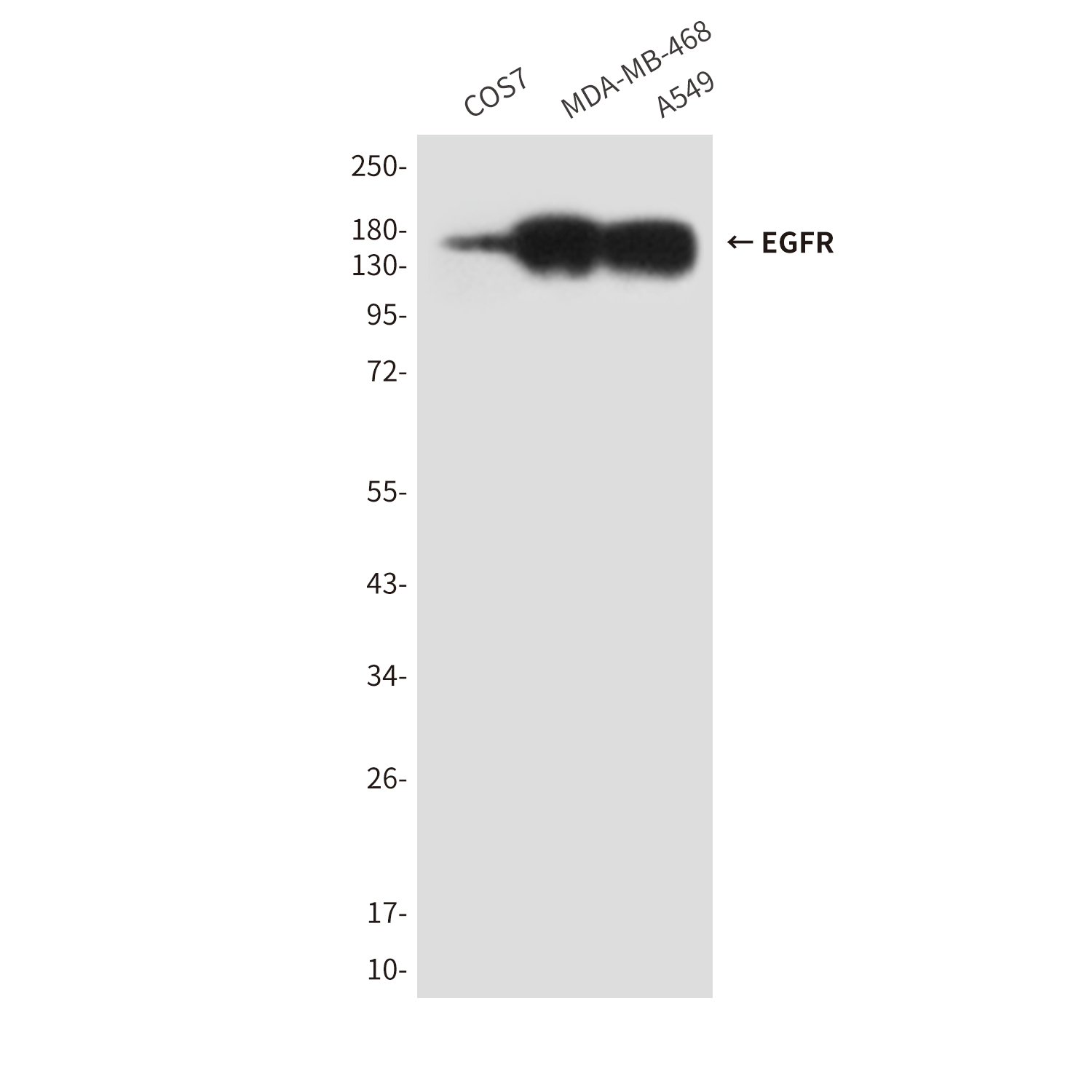 Anti-EGFR Mouse mAb [11K29M56]