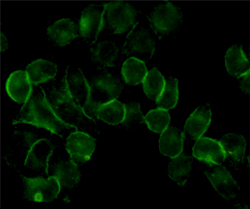 Anti-EGFR Mouse mAb [11K29M56]