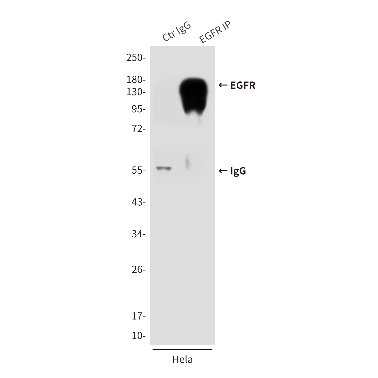 Anti-EGFR Mouse mAb [11K29M56]