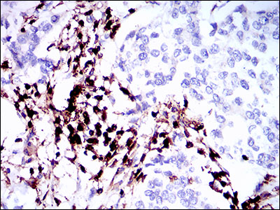 Anti-CD45 Mouse mAb [85L19L06]