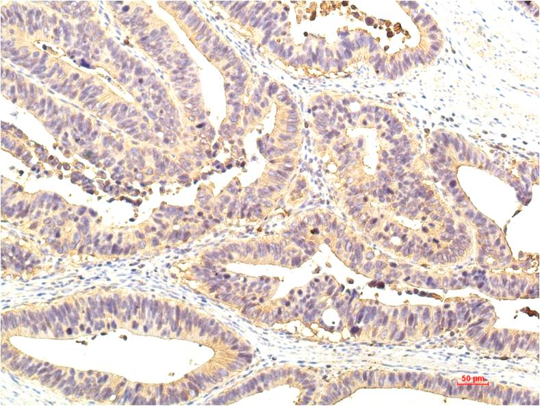 Anti-STAT1 Mouse mAb [87L97M11]
