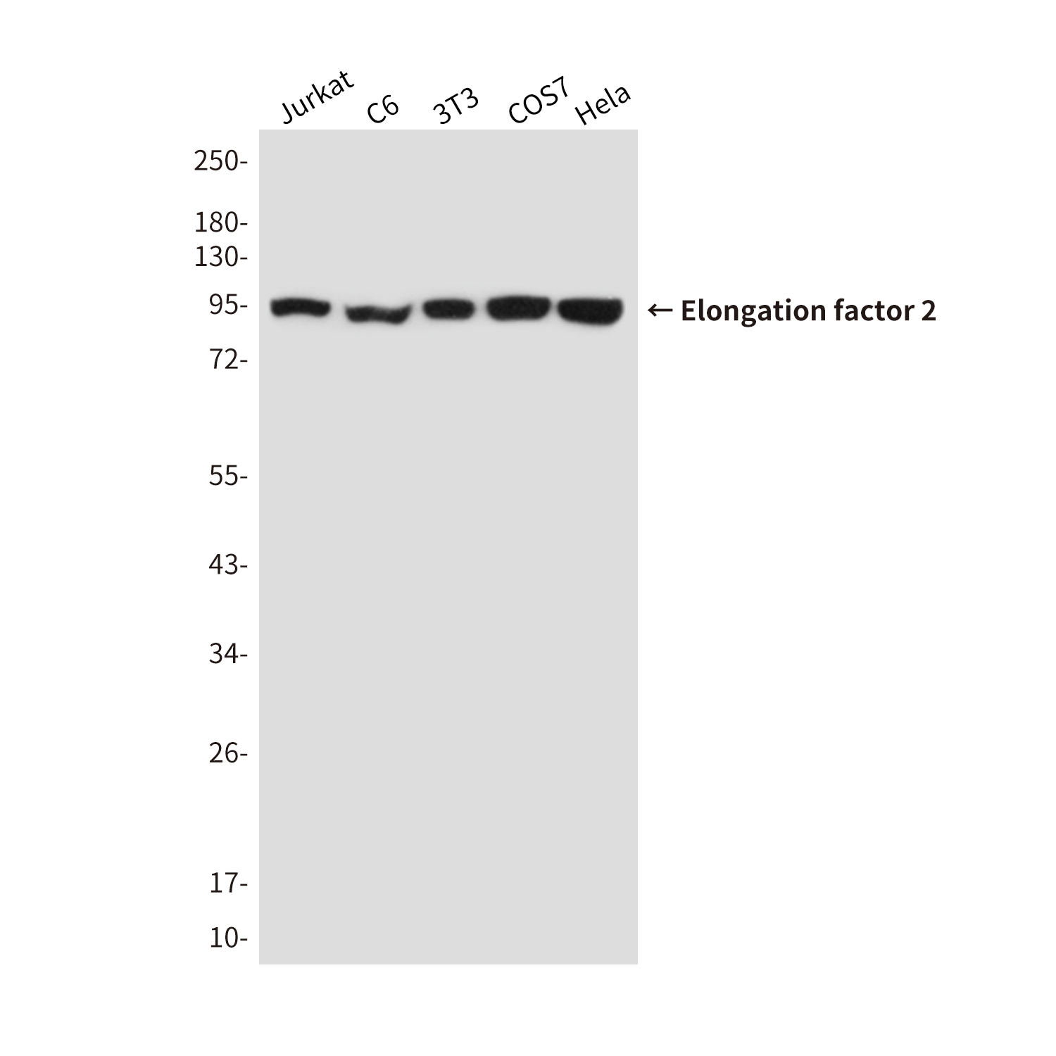 Anti-Elongation factor 2 Mouse mAb [75K59K29]